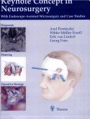 Keyhole Concept in Neurosurgery