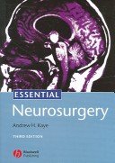 Essential Neurosurgery
