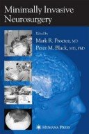 Minimally Invasive Neurosurgery
 