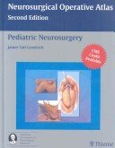 Pediatric Neurosurgery