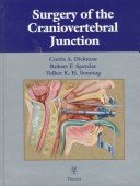 Surgery of the Craniovertebral Junction