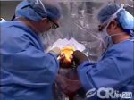 Deep brain stimulation