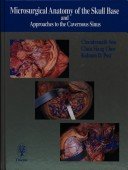 Microsurgical Anatomy of the Skull Base 