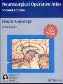 Neurosurgical Operative Atlas 